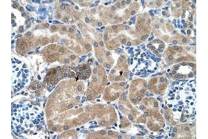 SDCBP antibody was used for immunohistochemistry at a concentration of 4-8 ug/ml to stain Epithelial cells of renal tubule (arrows) in Human Kidney. (SDCBP 抗体)