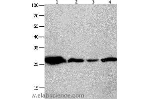 Western blot analysis of Mouse brain tissue, A549 cell and human lymphoma tissue, hela cell , using YWHAQ Polyclonal Antibody at dilution of 1:950 (14-3-3 theta 抗体)