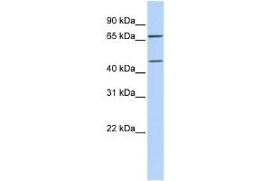 WB Suggested Anti-SLC5A7 Antibody Titration:  0. (ChT 抗体  (Middle Region))