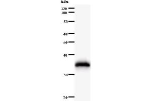 Western Blotting (WB) image for anti-Histidyl-tRNA Synthetase (HARS1) antibody (ABIN933100) (HARS1/Jo-1 抗体)