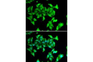 Immunofluorescence analysis of U20S cell using MYO1C antibody. (Myosin IC 抗体)