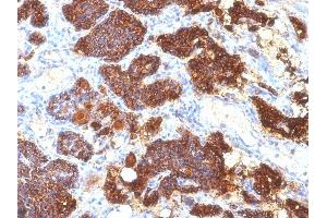Formalin-fixed, paraffin-embedded human Parathyroid Gland stained with PTH Mouse Monoclonal Antibody (PTH/1175). (PTH 抗体  (AA 32-115))