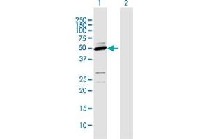 Western Blot analysis of CYP2D6 expression in transfected 293T cell line by CYP2D6 MaxPab polyclonal antibody. (CYP2D6 抗体  (AA 1-497))