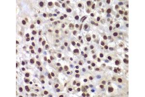 Immunohistochemistry (Paraffin-embedded Sections) (IHC (p)) image for anti-SWI/SNF Related, Matrix Associated, Actin Dependent Regulator of Chromatin, Subfamily B, Member 1 (SMARCB1) antibody (ABIN7261720)