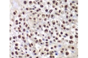 Immunohistochemistry of paraffin-embedded Mouse osteosarcoma using SMARCB1 Polyclonal Antibody at dilution of 1:200 (40x lens). (SMARCB1 抗体)