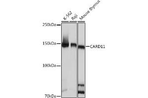 Western blot analysis of extracts of various cell lines, using C Rabbit mAb (ABIN7266125) at 1:1000 dilution. (CARD11 抗体)