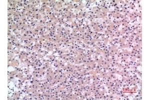 Immunohistochemical analysis of paraffin-embedded human-liver, antibody was diluted at 1:100. (CMTM6 抗体  (C-Term))