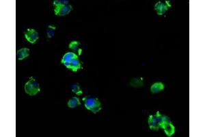 Immunofluorescence staining of MCF-7 cells with ABIN7144635 at 1:133, counter-stained with DAPI. (ARRDC1 抗体  (AA 288-433))