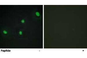 Immunofluorescence analysis of HepG2 cells, using CDCA4 polyclonal antibody . (CDCA4 抗体)