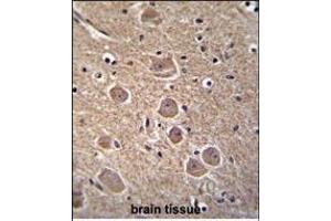 Immunohistochemistry (Paraffin-embedded Sections) (IHC (p)) image for anti-Tumor Protein P53 Inducible Nuclear Protein 1 (TP53INP1) (AA 36-64), (N-Term) antibody (ABIN655688)