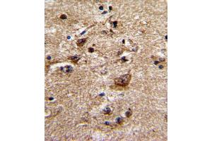 Formalin-fixed and paraffin-embedded human brain with ADRA1B Antibody (Center), which was peroxidase-conjugated to the secondary antibody, followed by DAB staining. (ADRA1B 抗体  (AA 270-297))