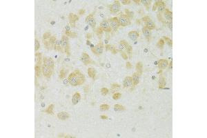 Immunohistochemistry of paraffin-embedded rat brain using SLC37 antibody (ABIN7270453) at dilution of 1:100 (40x lens). (SLC37A4 抗体  (C-Term))