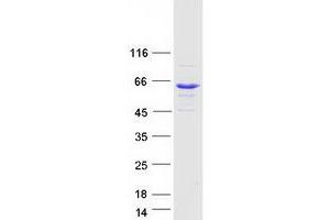 Validation with Western Blot