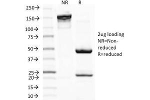 SDS-PAGE Analysis Purified MITF Mouse Monoclonal Antibody (D5). (MITF 抗体)