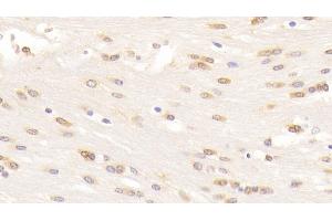 Immunohistochemistry (IHC) image for anti-Wingless-Type MMTV Integration Site Family, Member 5A (WNT5A) (AA 62-380) antibody (ABIN7428821)