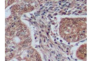 Immunohistochemistry (IHC) image for anti-Antigen Identified By Monoclonal Antibody Ki-67 (MKI67) (AA 2815-2928) antibody (ABIN7434599)
