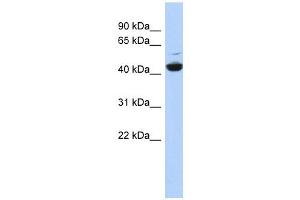 Western Blotting (WB) image for anti-ATPase, H+ Transporting, Lysosomal 42kDa, V1 Subunit C1 (ATP6V1C1) (N-Term) antibody (ABIN631307)