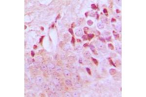 Immunohistochemical analysis of TSC2 (pT1462) staining in human brain formalin fixed paraffin embedded tissue section. (Tuberin 抗体  (C-Term, pSer1462))