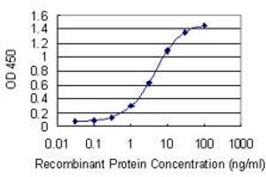 Detection limit for recombinant GST tagged MTMR3 is 0. (MTMR3 抗体  (AA 579-674))