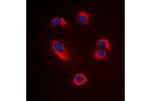 Immunofluorescent analysis of MMP10 staining in Jurkat cells. (MMP10 抗体  (C-Term))