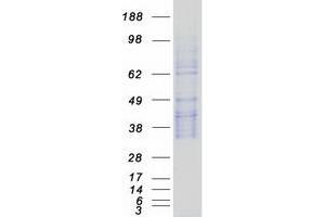 Validation with Western Blot
