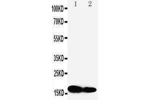 Anti-IFITM1 antibody, Western blotting Lane 1: SW620 Cell Lysate Lane 2: CEM Cell Lysate