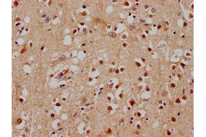 IHC image of ABIN7140181 diluted at 1:100 and staining in paraffin-embedded human brain tissue performed on a Leica BondTM system. (SOX1 抗体  (AA 49-68))