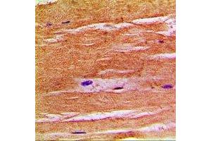 Immunohistochemical analysis of NHE8 staining in human skeletal muscle formalin fixed paraffin embedded tissue section. (NHE8 抗体  (C-Term))