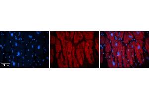 Rabbit Anti-KIF23 Antibody    Formalin Fixed Paraffin Embedded Tissue: Human Adult heart  Observed Staining: Cytoplasmic (cytoskeleton) Primary Antibody Concentration: 1:600 Secondary Antibody: Donkey anti-Rabbit-Cy2/3 Secondary Antibody Concentration: 1:200 Magnification: 20X Exposure Time: 0. (KIF23 抗体  (Middle Region))