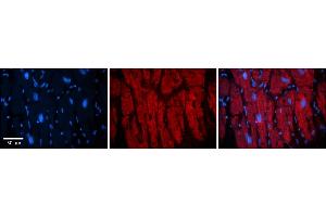 Rabbit Anti-KIF23 Antibody    Formalin Fixed Paraffin Embedded Tissue: Human Adult heart  Observed Staining: Cytoplasmic (cytoskeleton) Primary Antibody Concentration: 1:600 Secondary Antibody: Donkey anti-Rabbit-Cy2/3 Secondary Antibody Concentration: 1:200 Magnification: 20X Exposure Time: 0. (KIF23 抗体  (Middle Region))