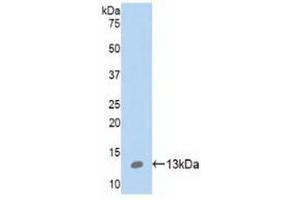Detection of Recombinant S100A10, Human using Polyclonal Antibody to S100 Calcium Binding Protein A10 (S100A10) (S100A10 抗体  (AA 1-96))