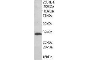 Image no. 1 for anti-Thioredoxin-Related Transmembrane Protein 1 (TMX1) (C-Term) antibody (ABIN374090) (TMX1 抗体  (C-Term))