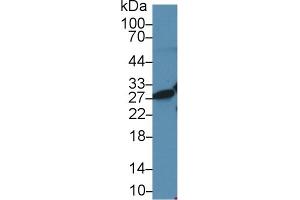 Western blot analysis of Human Jurkat cell lysate, using Rat HMG1 Antibody (2 µg/ml) and HRP-conjugated Goat Anti-Rabbit antibody ( (HMGB1 抗体  (AA 1-215))