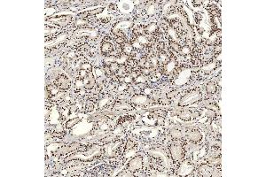 IHC analysis of U1A/SNRPA using anti-U1A/SNRPA antibody (ABIN7600891). (SNRPA1 抗体  (AA 25-218))