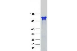 Western Blotting (WB) image for Catenin (Cadherin-Associated Protein), alpha 1, 102kDa (CTNNA1) protein (Myc-DYKDDDDK Tag) (ABIN2713216)