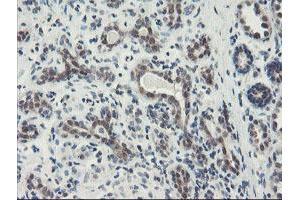 Immunohistochemical staining of paraffin-embedded Human breast tissue using anti-DPH2 mouse monoclonal antibody. (DPH2 抗体)