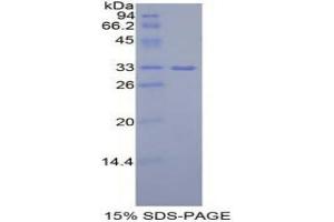 SDS-PAGE analysis of Mouse IGF2BP2 Protein. (IGF2BP2 蛋白)