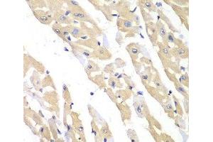Immunohistochemistry of paraffin-embedded Mouse heart using CCT3 Polyclonal Antibody at dilution of 1:100 (40x lens). (CCT3 抗体)