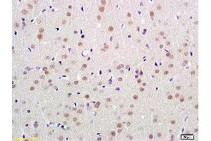 Formalin-fixed and paraffin embedded rat brain labeled with Anti-UBL7 Polyclonal Antibody, Unconjugated  at 1:100 followed by conjugation to the secondary antibody and DAB staining (UBL7 抗体  (AA 51-150))