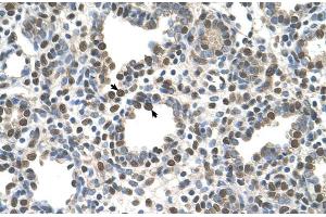Immunohistochemistry (IHC) image for anti-Zinc Finger, DHHC-Type Containing 13 (ZDHHC13) (N-Term) antibody (ABIN2781846)