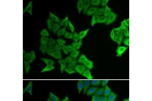 Immunofluorescence analysis of HeLa cells using GJA5 Polyclonal Antibody (Cx40/GJA5 抗体)