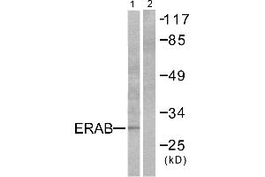 Western blot analysis of extracts from LOVO cells, using ERAB antibody.