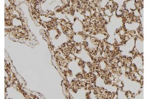 ABIN6258131 and ABIN6275518 at 1/100 staining Rat lung tissue by IHC-P.