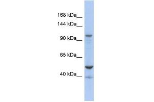 WB Suggested Anti-DDX58 Antibody Titration:  0. (DDX58 抗体  (Middle Region))