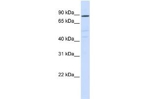 Western Blotting (WB) image for anti-ATPase, H+ Transporting, Lysosomal V0 Subunit A2 (ATP6V0A2) (N-Term) antibody (ABIN2775376)