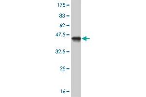 Western Blot detection against Immunogen (41. (MED21 抗体  (AA 1-144))