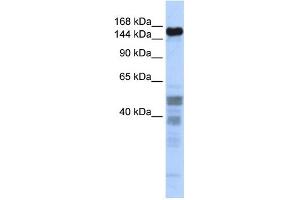 WB Suggested Anti-ZNF335 Antibody Titration:  0. (ZNF335 抗体  (Middle Region))