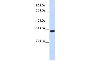 WB Suggested Anti-RCAN1 Antibody Titration:  0. (RCAN1 抗体  (Middle Region))