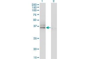 Western Blot analysis of ASGR2 expression in transfected 293T cell line by ASGR2 monoclonal antibody (M05), clone 1D7. (Asialoglycoprotein Receptor 2 抗体  (AA 1-287))
