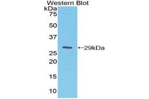 Detection of Recombinant FcgRI, Mouse using Polyclonal Antibody to Cluster Of Differentiation 64 (CD64)